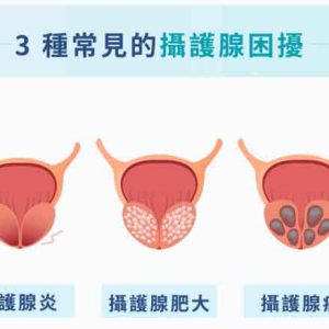攝護腺炎能喝菊花茶嗎？慢性病人輔助緩解症狀的醫師指南